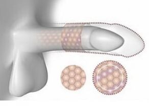 An increase in penis in volume